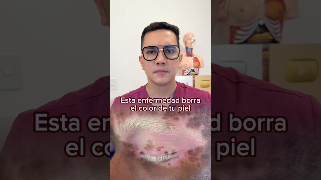 manchas en la piel por fibromialgia