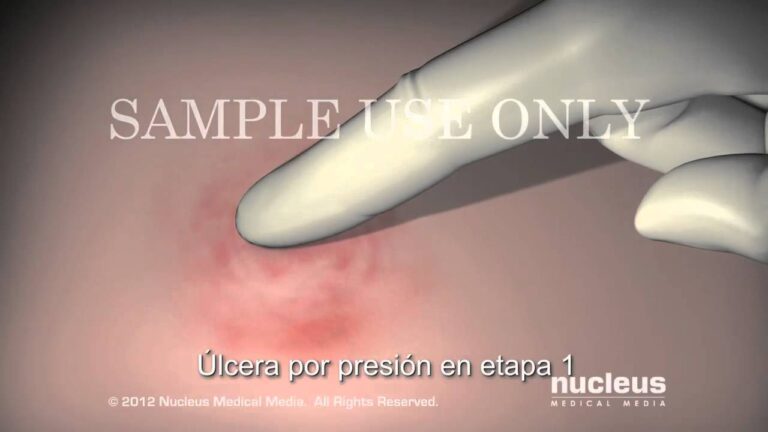 marcas en la piel por presion