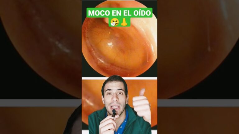 mocos en el oido remedios