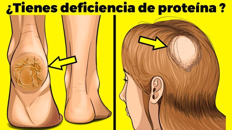 muerte por falta de proteínas