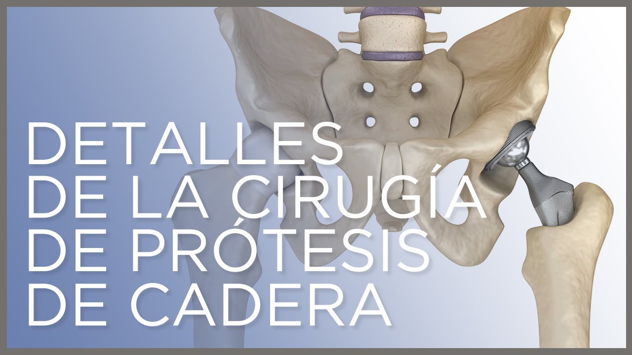 operacion de cadera en persona mayor