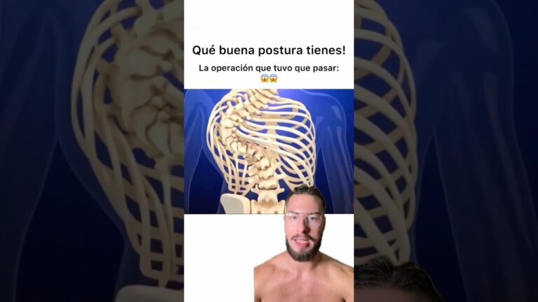 operación de escoliosis en adultos