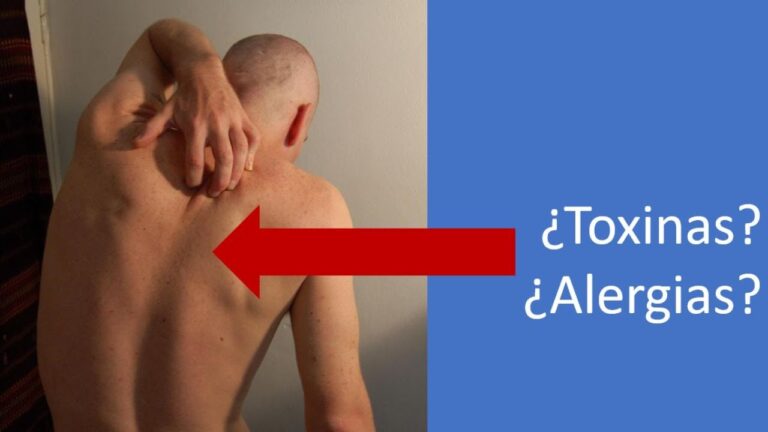 picores y hormigueo por todo el cuerpo