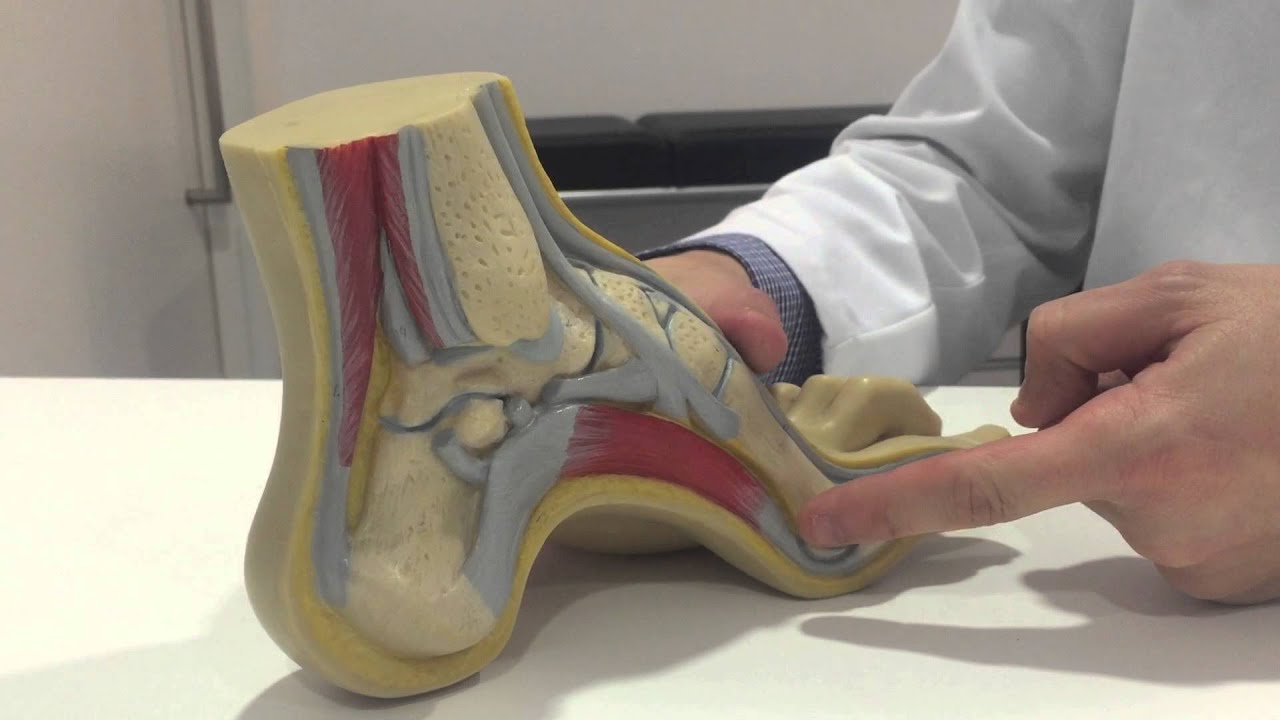 pie cavo grado de discapacidad