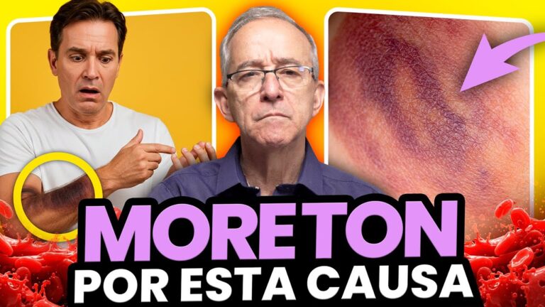 pies morados en personas mayores