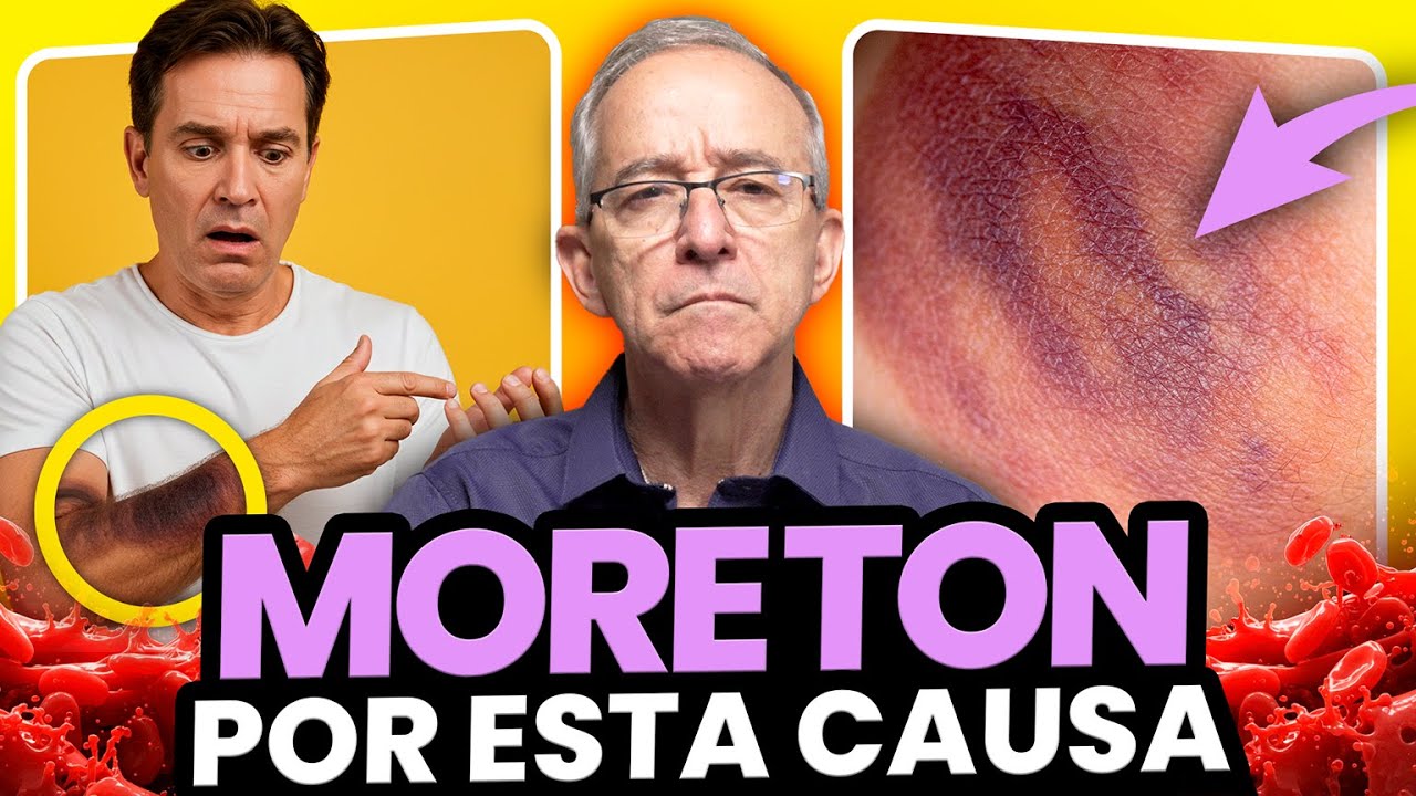 pies morados en personas mayores