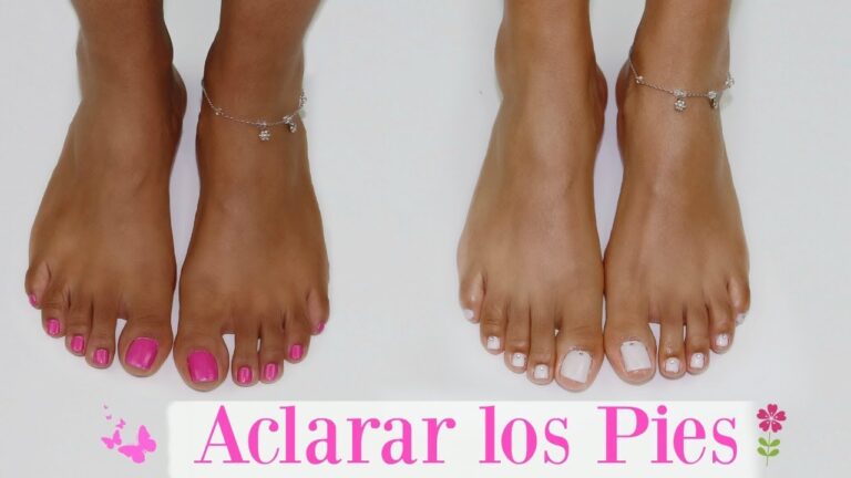 pies quemados por el sol