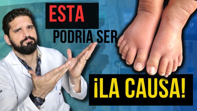 porqué se hinchan los pies