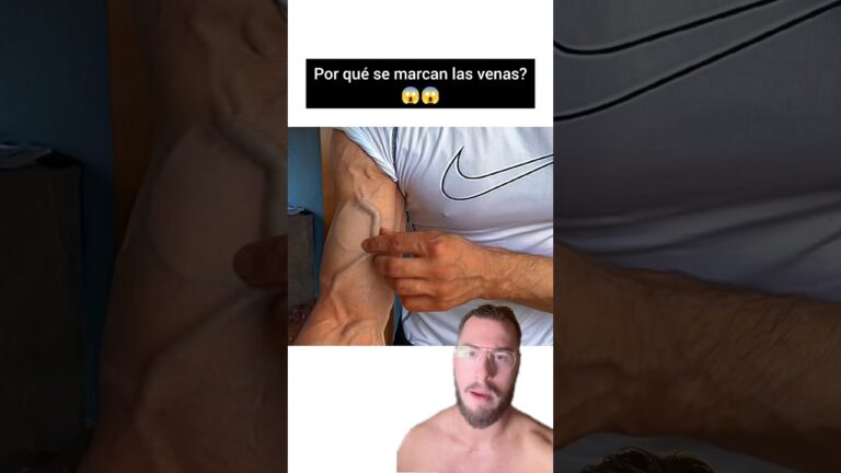 pq se marcan las venas