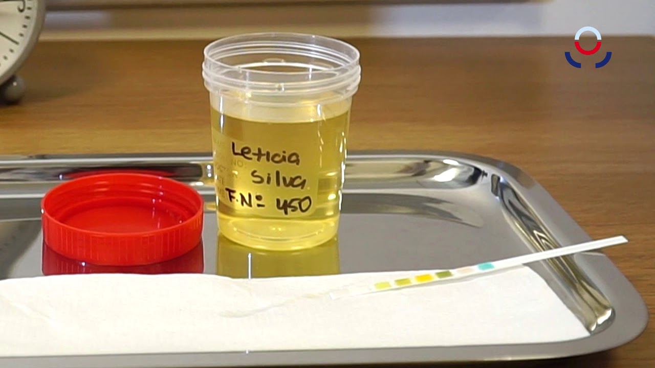 prueba casera infeccion de orina