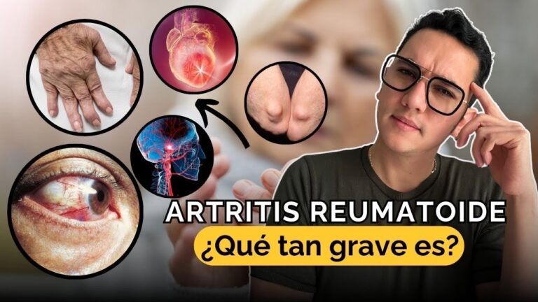 puede morir una persona de artritis reumatoide