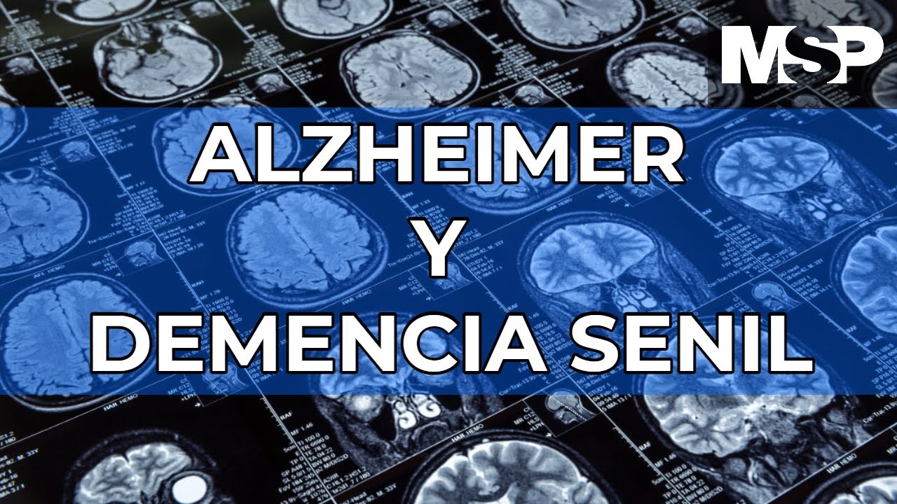 qué diferencia hay entre alzheimer y demencia senil