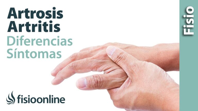 qué diferencia hay entre artritis y artrosis