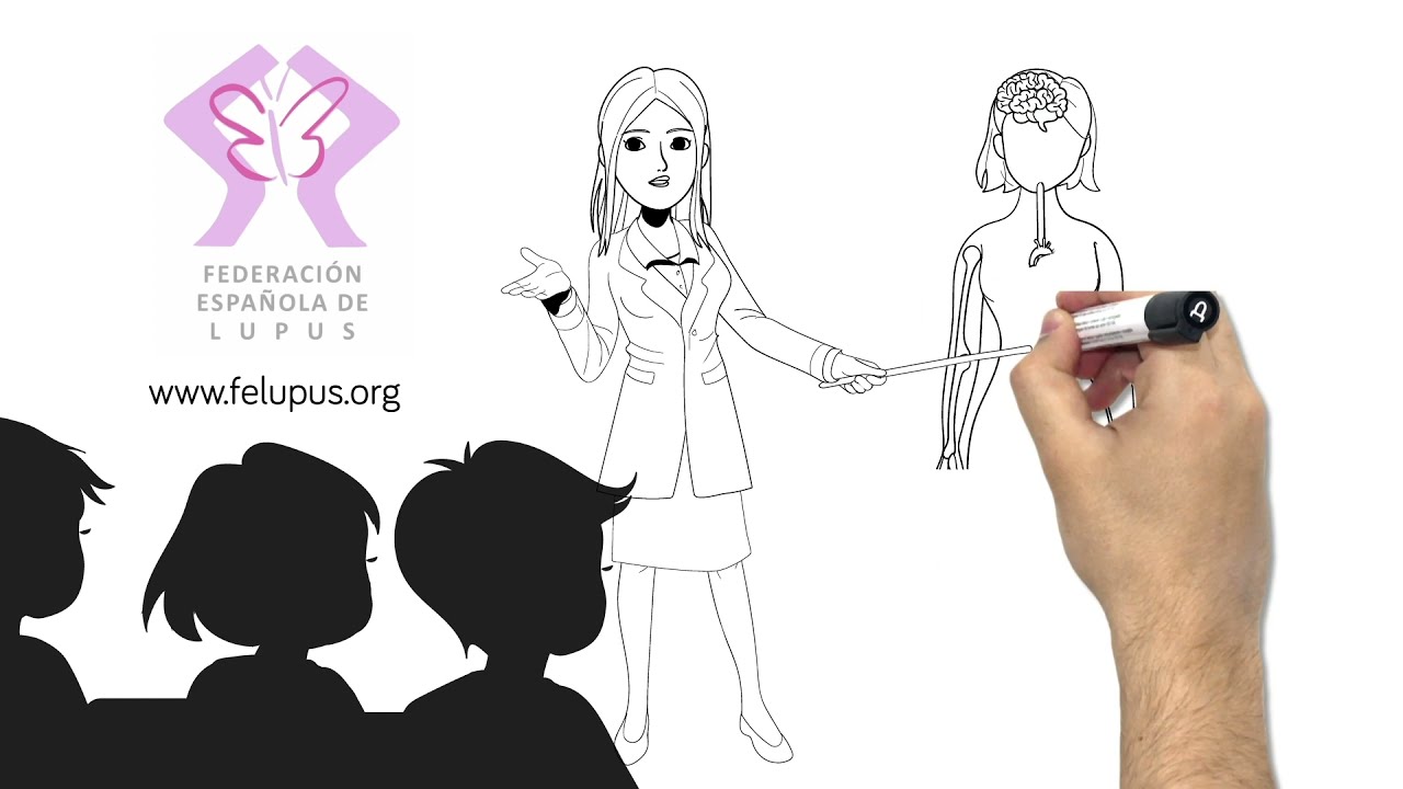 qué es la enfermedad del lupus