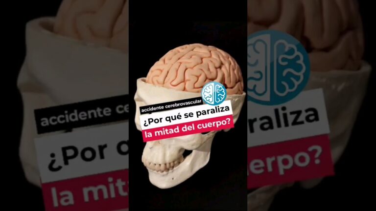 qué tipo de ictus tiene mayor mortalidad