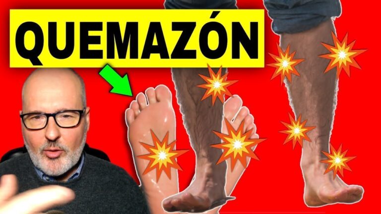 quemazón en la pierna izquierda