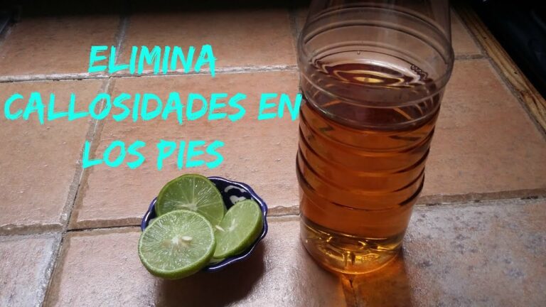 quitar durezas pies remedios caseros