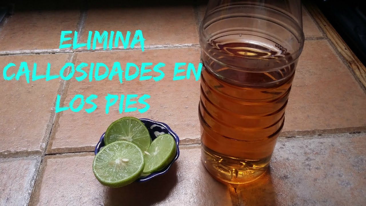 quitar durezas pies remedios caseros