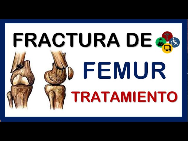 recuperacion de rotura de femur