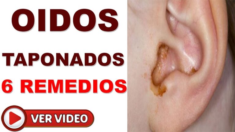 remedios casero para destapar el oido
