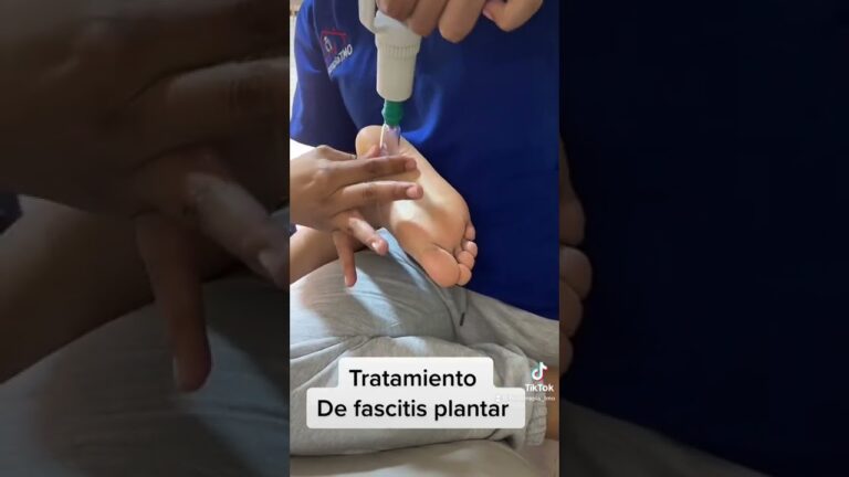 remedios para la fascitis plantar