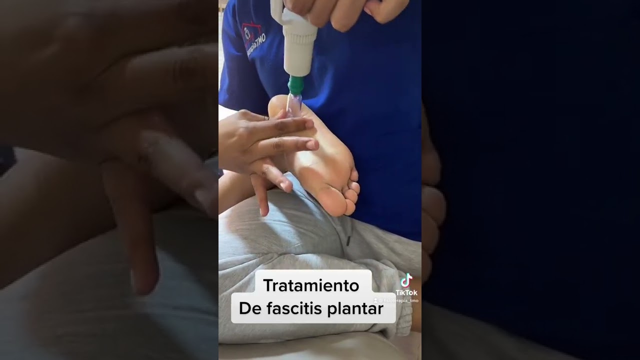 remedios para la fascitis plantar
