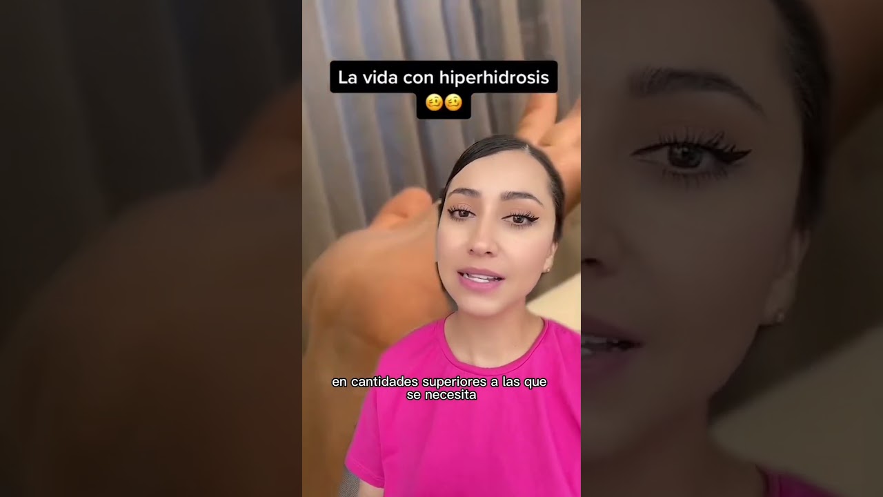 remedios para no sudar las manos