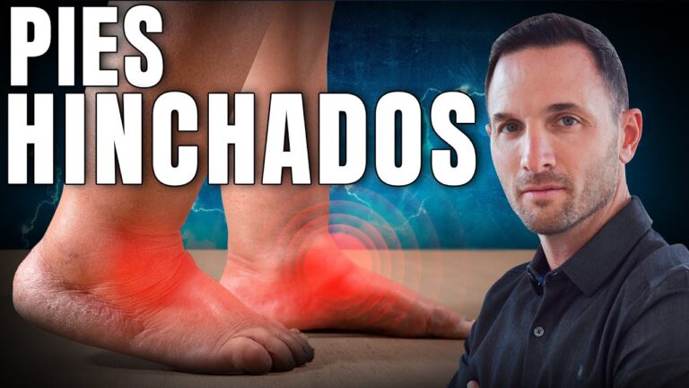 retencion de liquidos pies hinchados