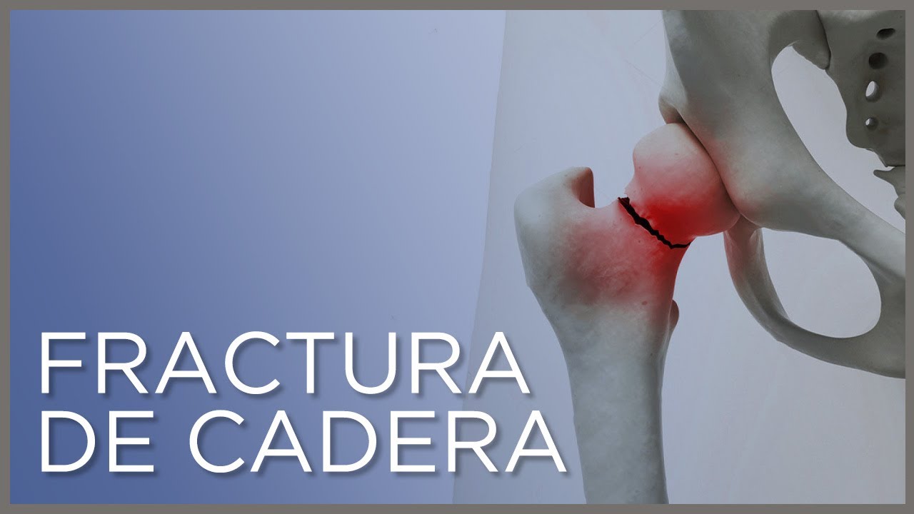 rotura de cadera en ancianos