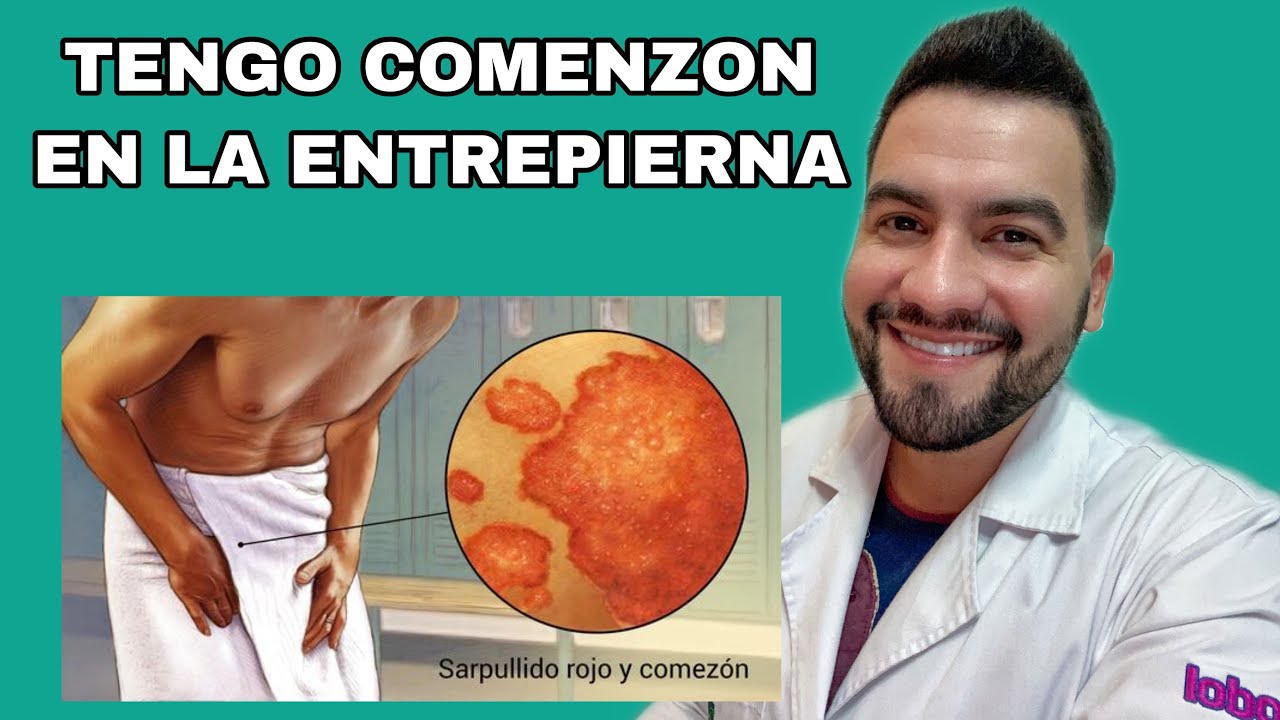 rozaduras en las ingles remedios caseros