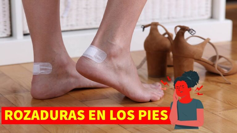 rozaduras en los pies remedios caseros
