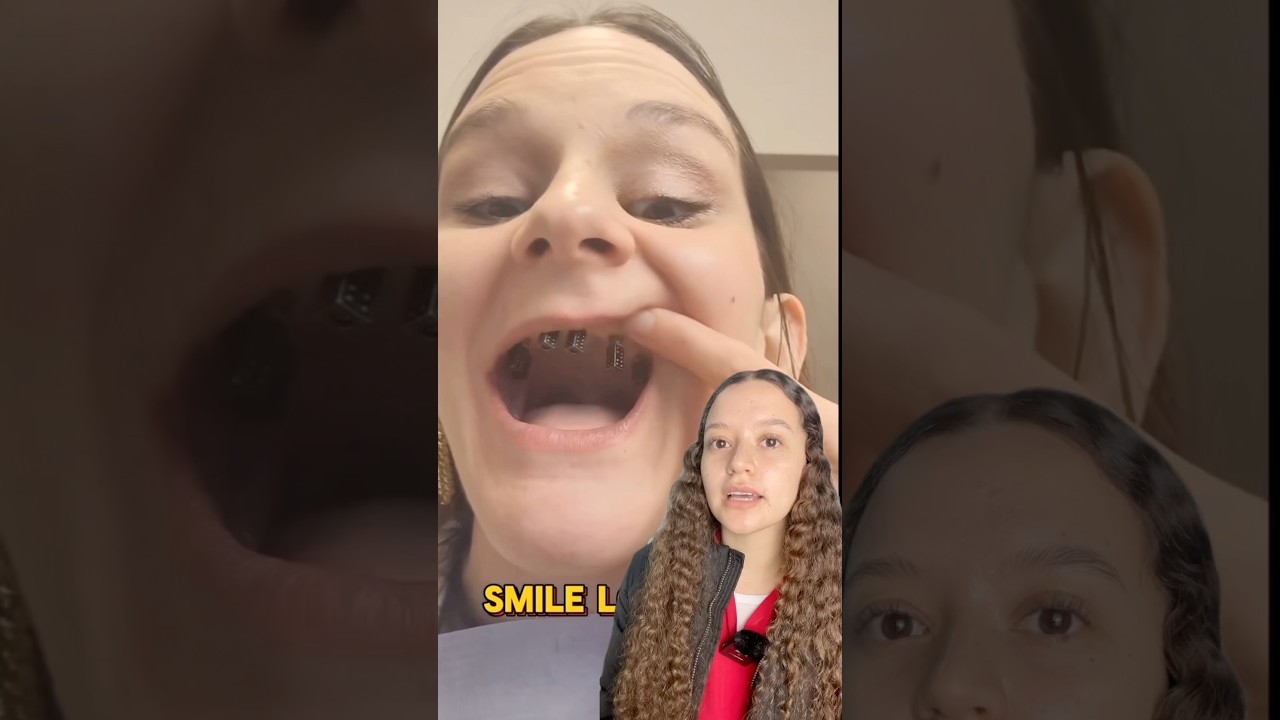 sacar dientes y poner protesis