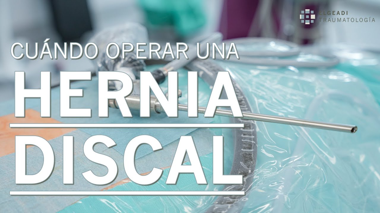 se debe operar una hernia discal