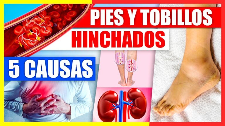 se me hinchan los pies y tobillos