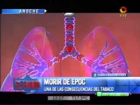 se puede morir de epoc