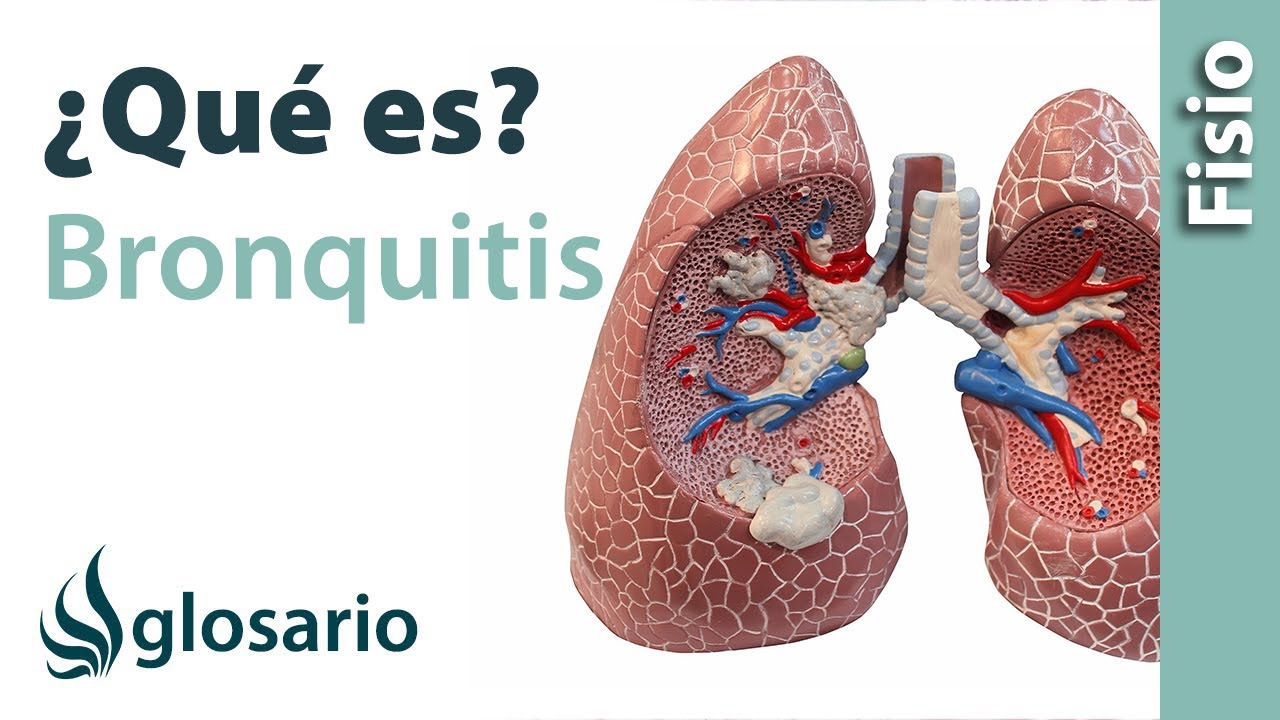 se puede tener bronquitis y neumonía a la vez