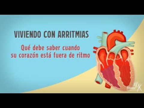 se puede vivir con arritmia