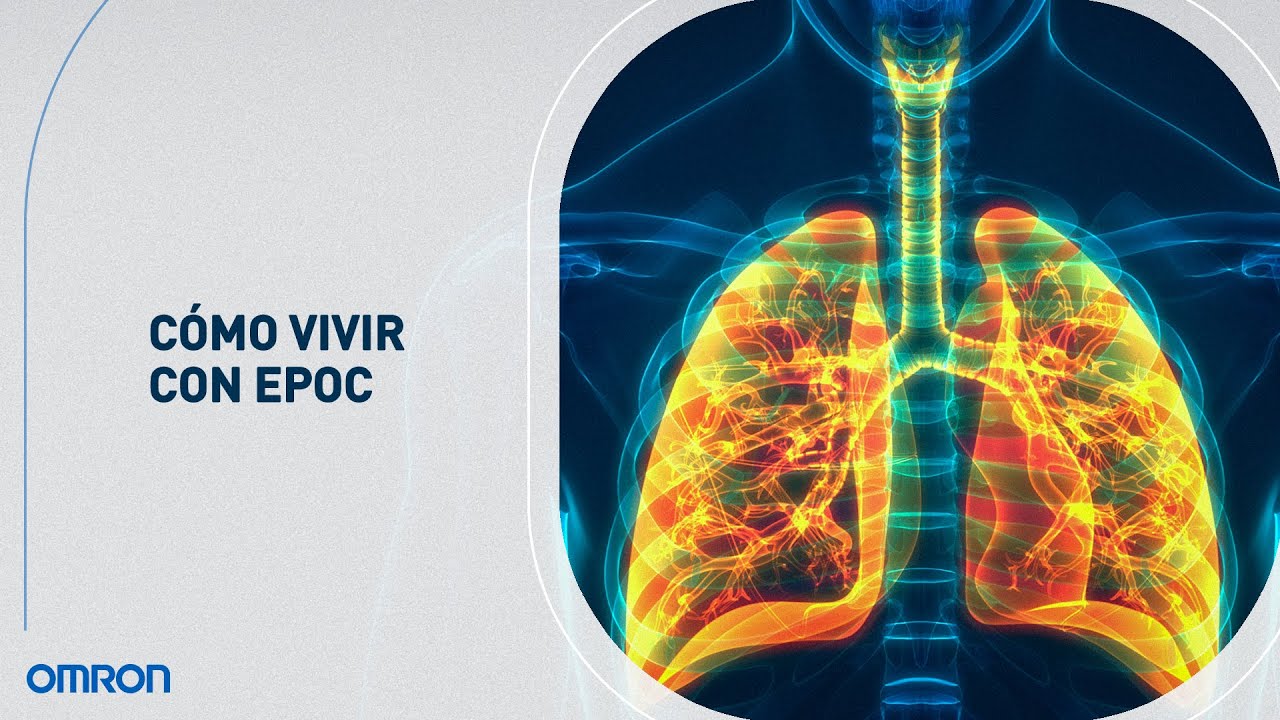 se puede vivir con epoc