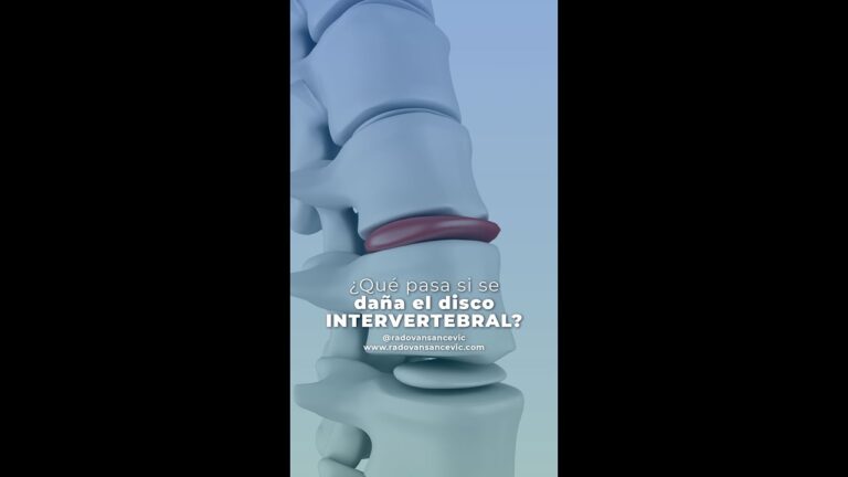 se puede vivir sin disco intervertebral