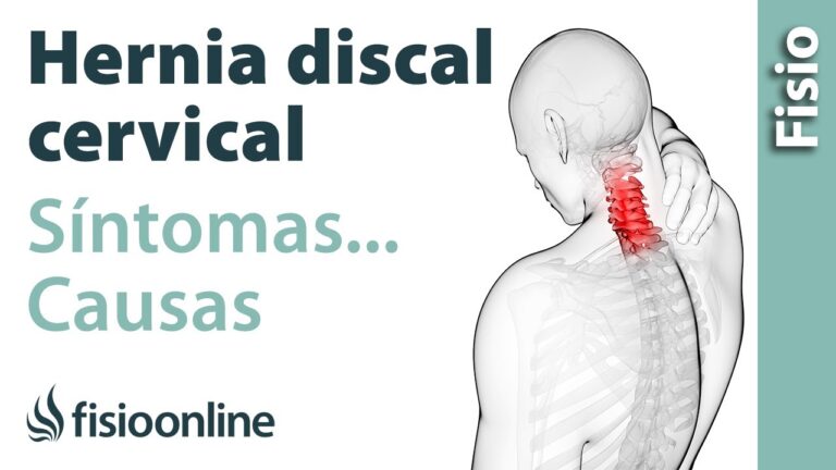 sintomas de la hernia de disco cervical