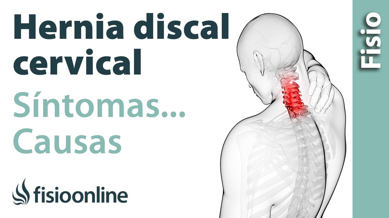 sintomas de la hernia de disco cervical