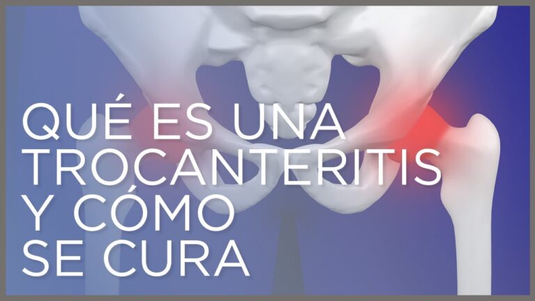 sintomas de la trocanteritis en cadera