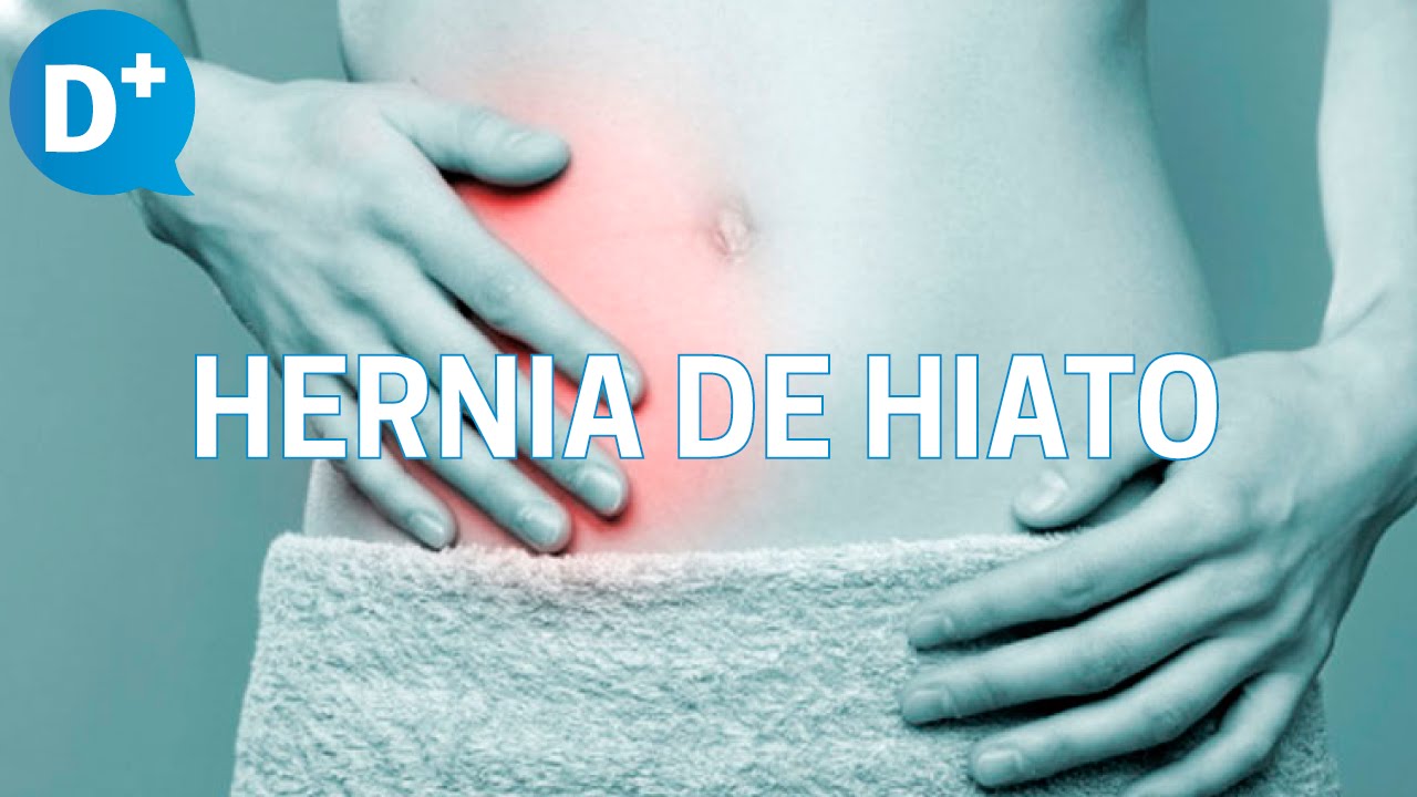síntomas de una hernia de hiato