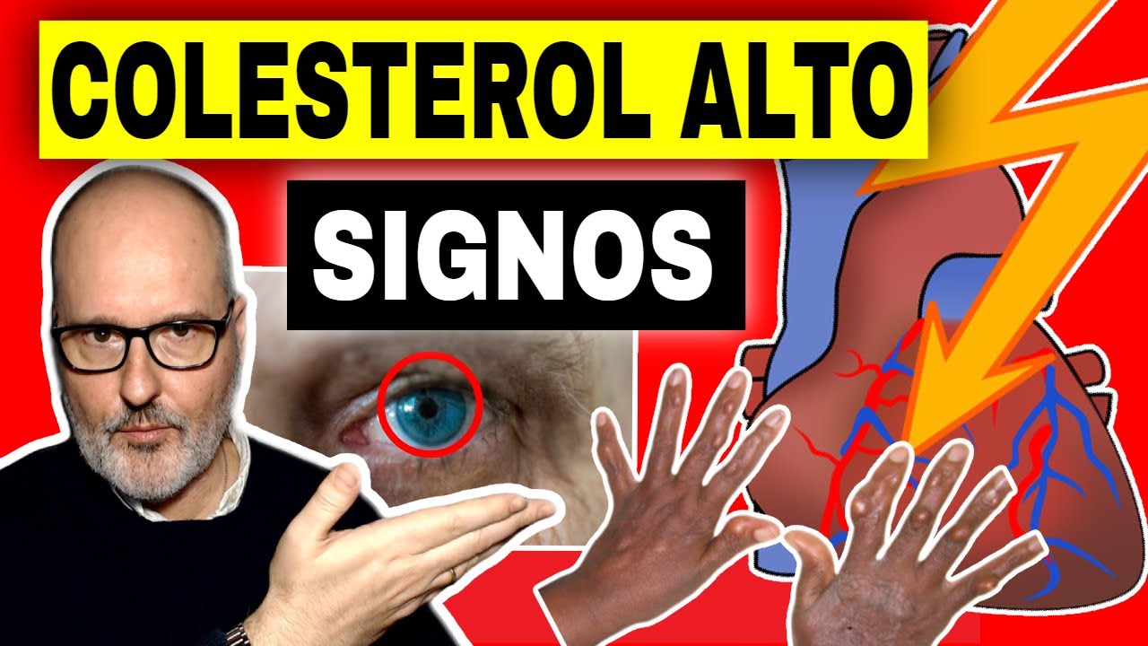 síntomas del colesterol alto en mujeres