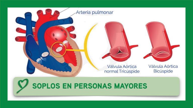 soplo en el corazon personas mayores