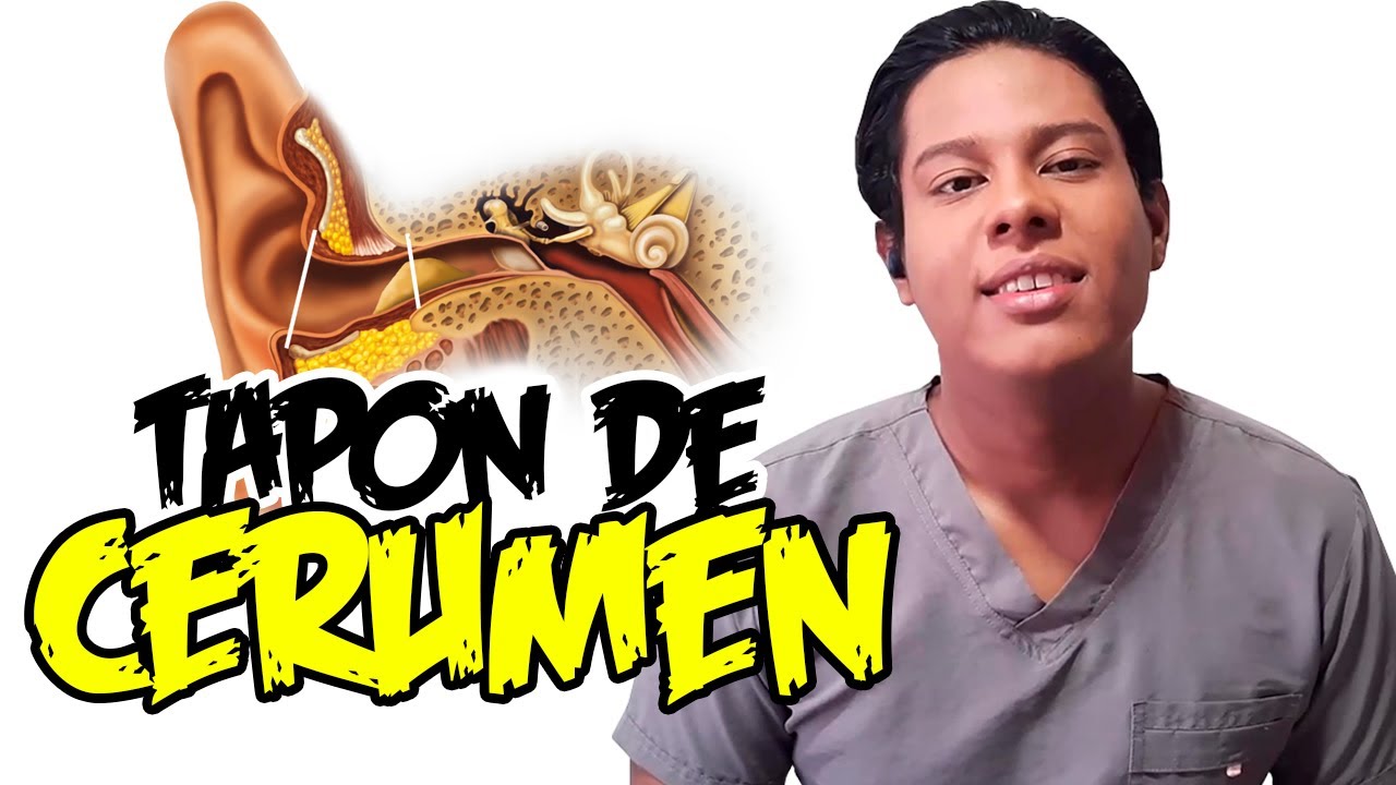 tapón de cera oído síntomas