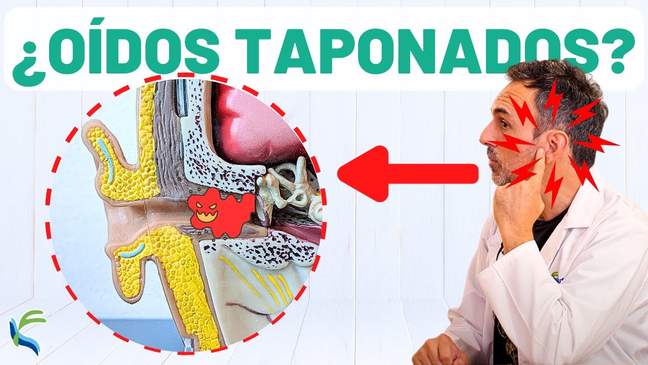 tengo el oido taponado que hago