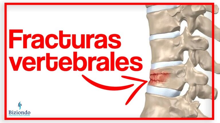 tiempo de baja por fractura vertebral