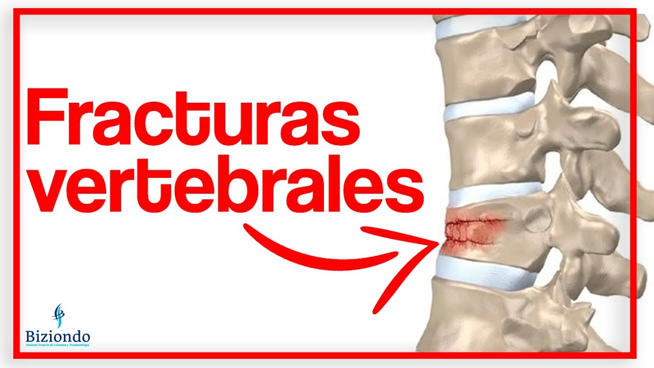 tiempo de baja por fractura vertebral