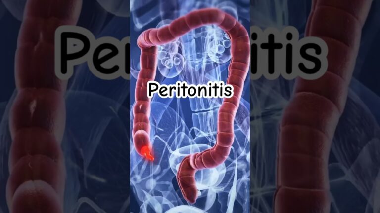 tiempo de baja por peritonitis